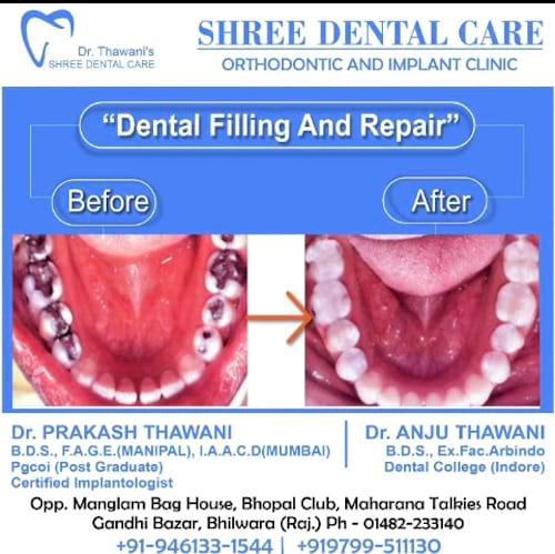 Shree Dental Care in India