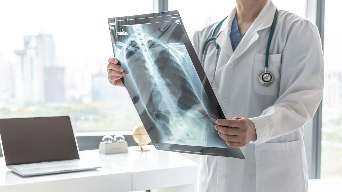 Sindromul de detresă respiratorie acută (SDRA): cauze, simptome, tratament