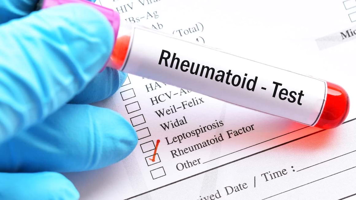 Factorul Reumatoid: Ce este? Cum se masoara si ce boli indica