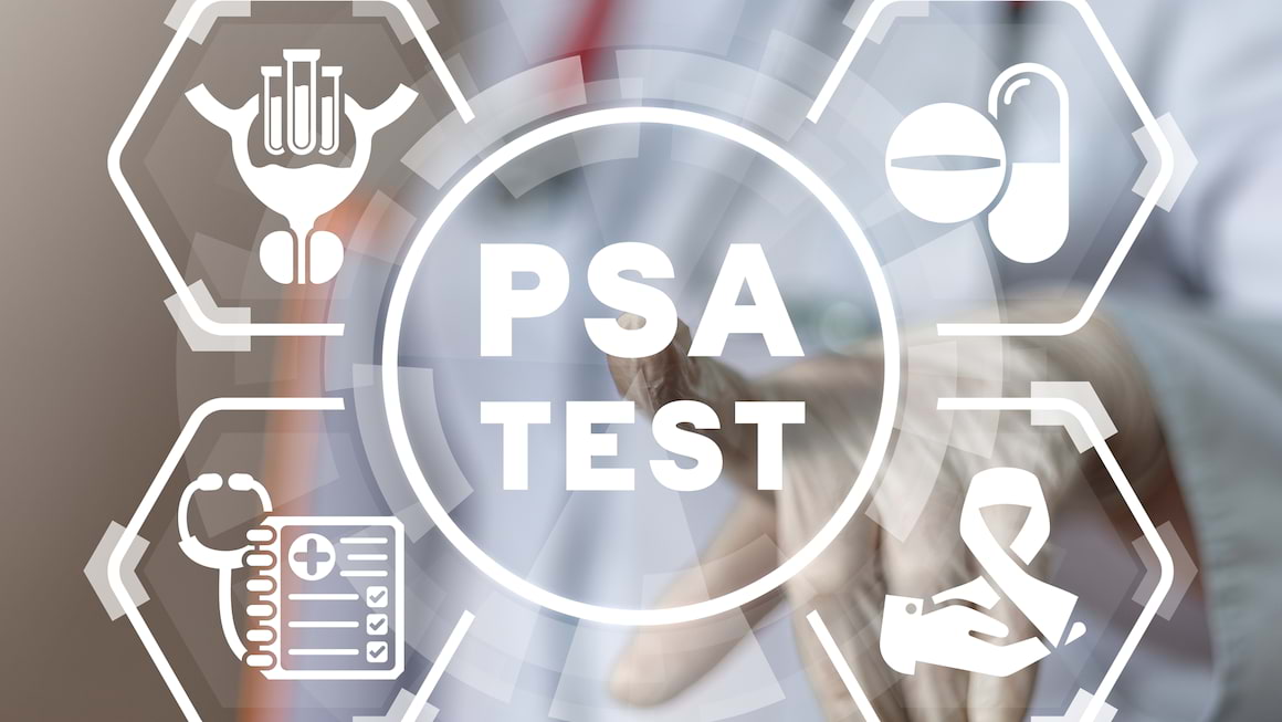 Antigenul prostatic specific (PSA): un biomarker al cancerului de prostata inca actual sau depasit?