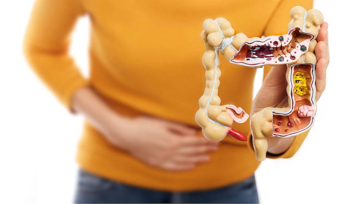 Potential tratament nou pentru bolile inflamatorii intestinale