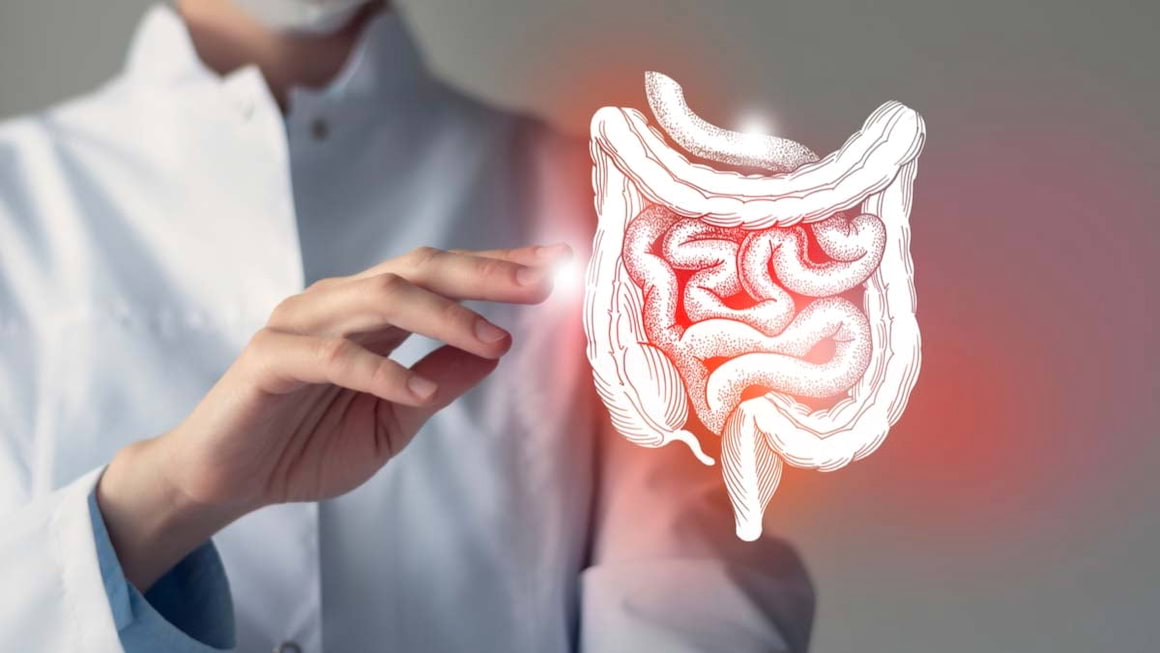 Riscul de adenocarcinom in colita ulcerativa