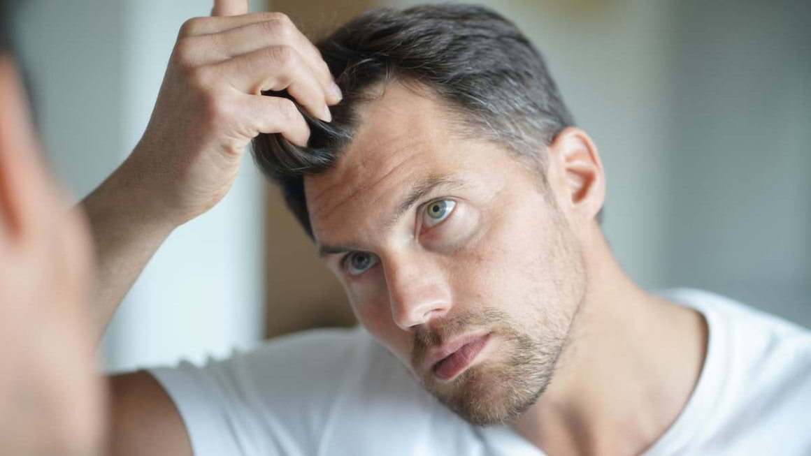 Alopecia: cauze, simptome si tratament