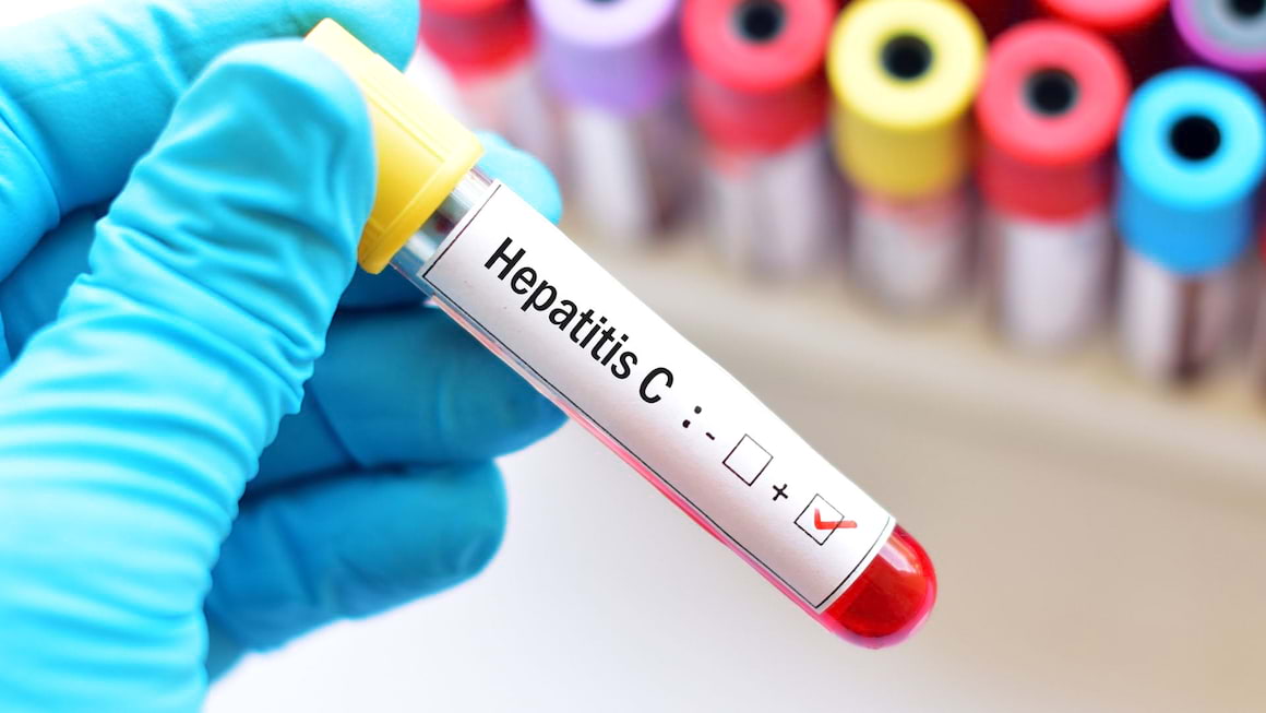 Cauzele si modurile de transmitere ale Hepatitei C