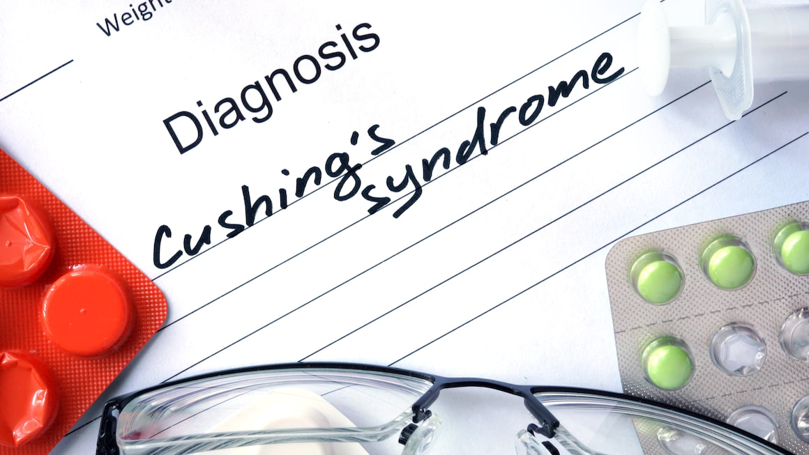 Sindromul Cushing: cauze, simptome si complicatii