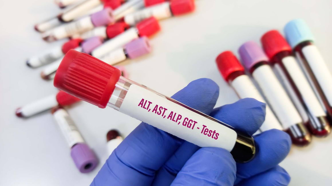 Metode uzuale de investigare a ficatului afectat de hepatita