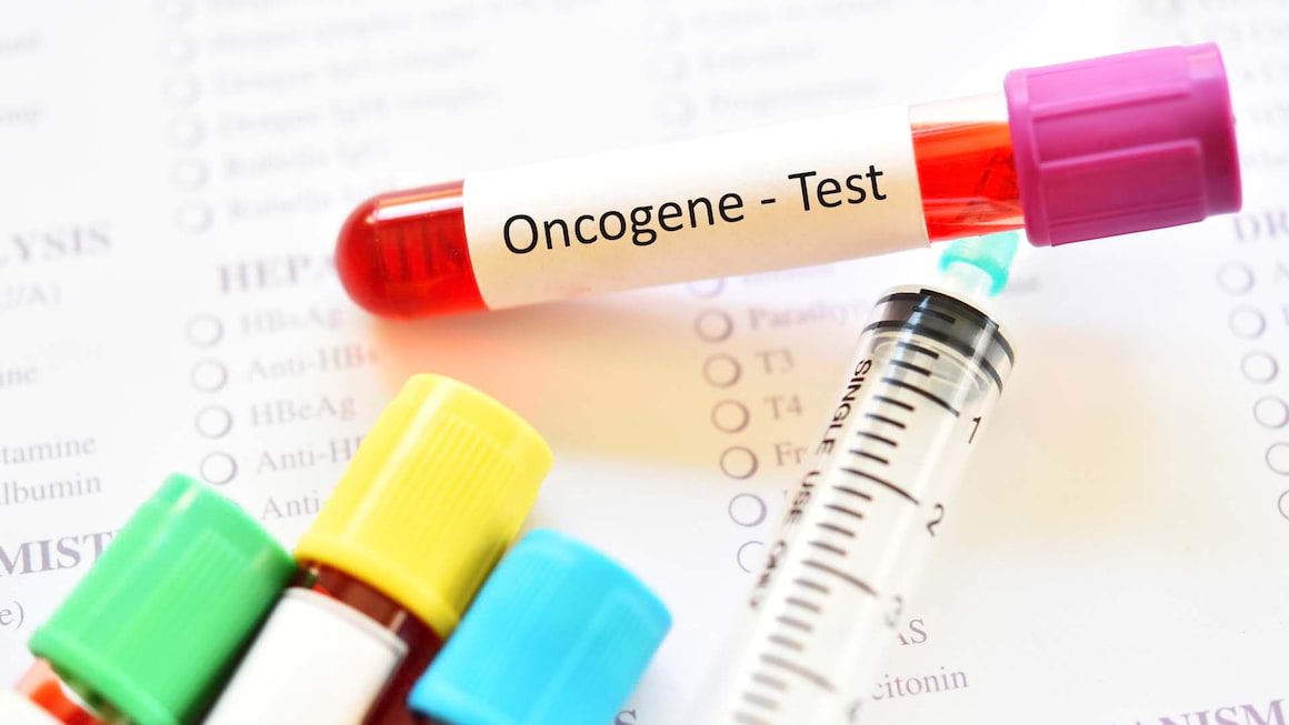 Rolul testărilor genetice în cancerul mamar: mii de femei ar putea să nu mai facă chimioterapie