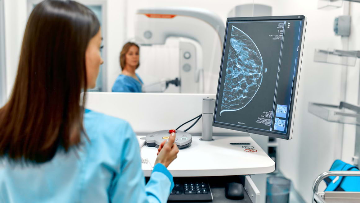 Densitatea tesutului mamar ar putea fi principalul indicator de risc pentru cancer