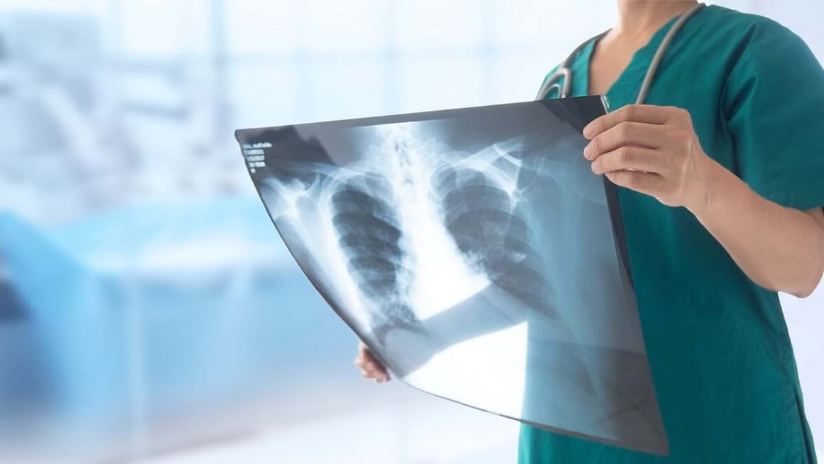 Pneumonia ambulantă: simptome, cauze și tratament