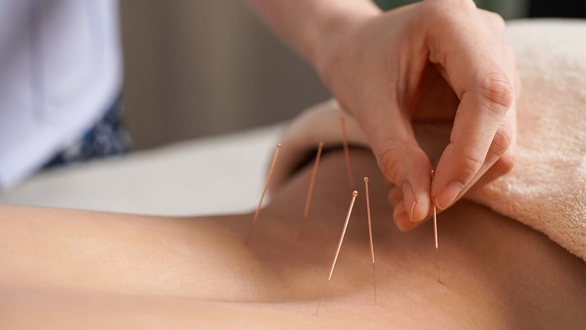Acupunctura pentru tratarea durerilor lombare