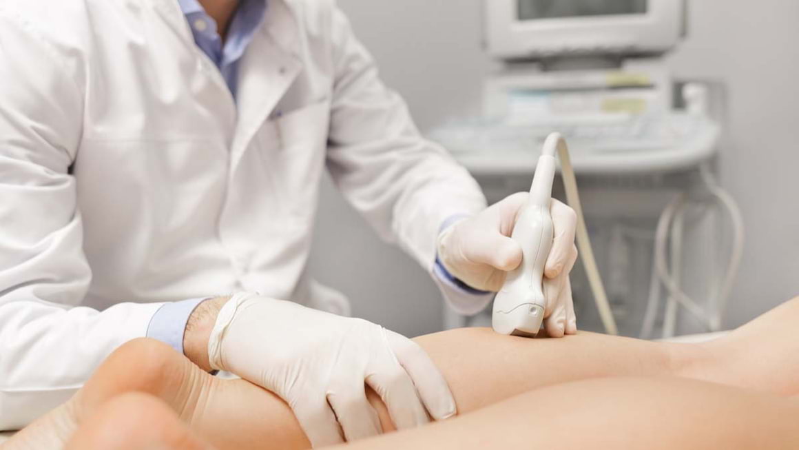 Terapia ablativa a varicelor membrelor inferioare