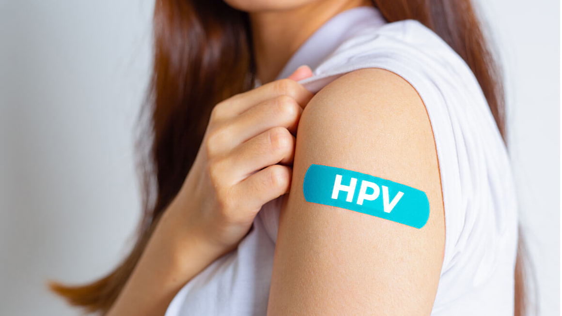Virusul papiloma (human papillomavirus) și riscul de cancer