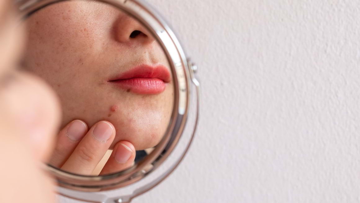 10 modificari ale pielii care ar trebui sa te trimita la medicul dermatolog