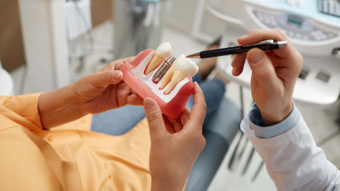 Ce avantaje are implantul dentar realizat în totalitate din ceramică