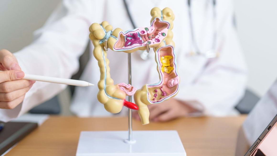 Simptomele cancerului de colon pe care si tinerii trebuie sa le stie