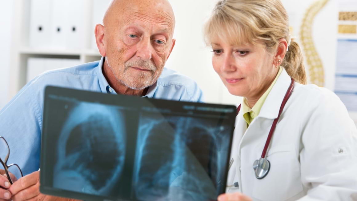 Cauzele cancerului pulmonar