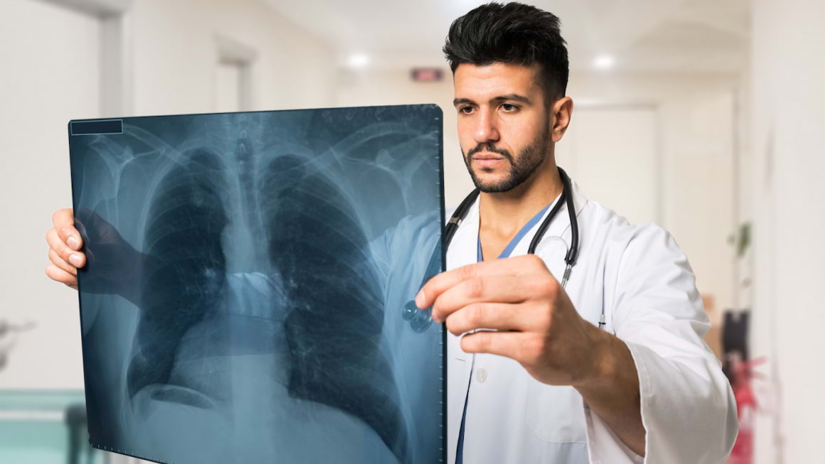 Nodulul pulmonar solitar: simptome, diagnostic, complicatii
