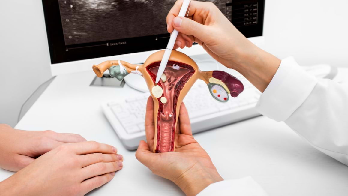 Hiperplazie endometriala: simptome, cauze, tratament