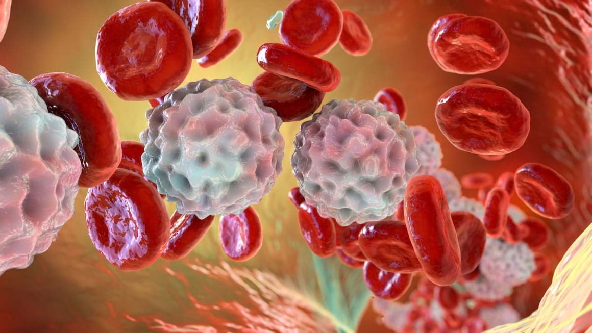 Limfocitoza: cauze, diagnostic, tratament