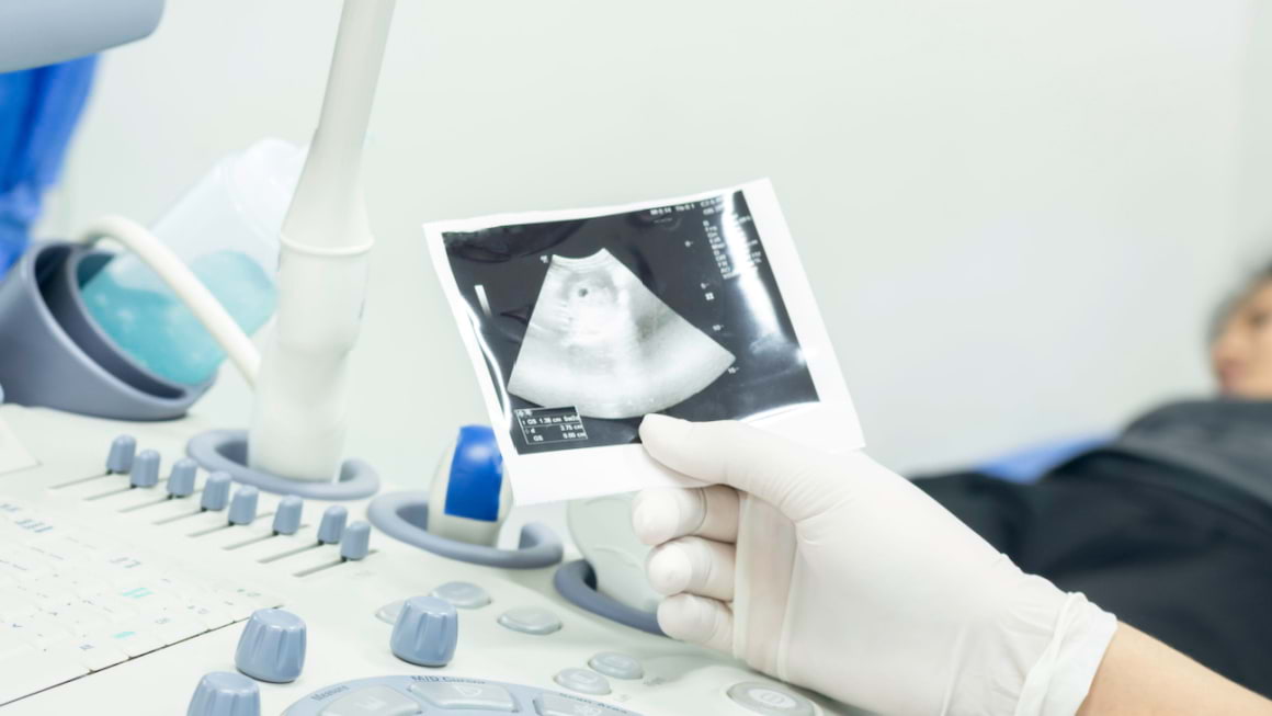Placenta Praevia: definitie, simptome, cauze si complicatii