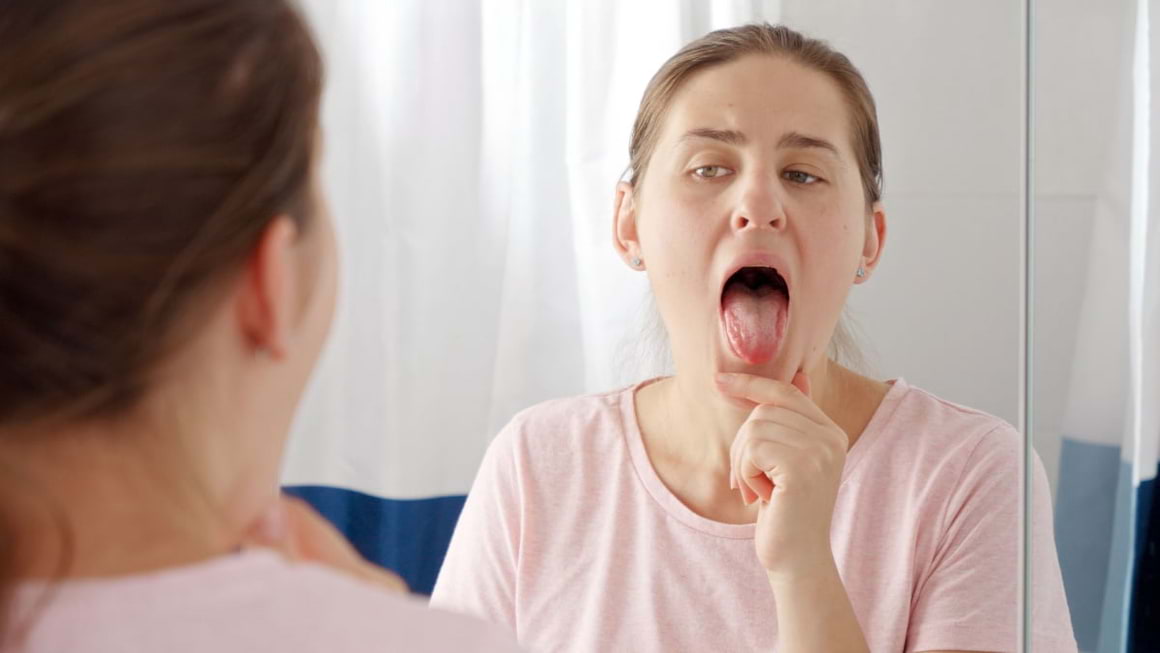 Primele simptome ale cancerului oral (cancerul limbii)