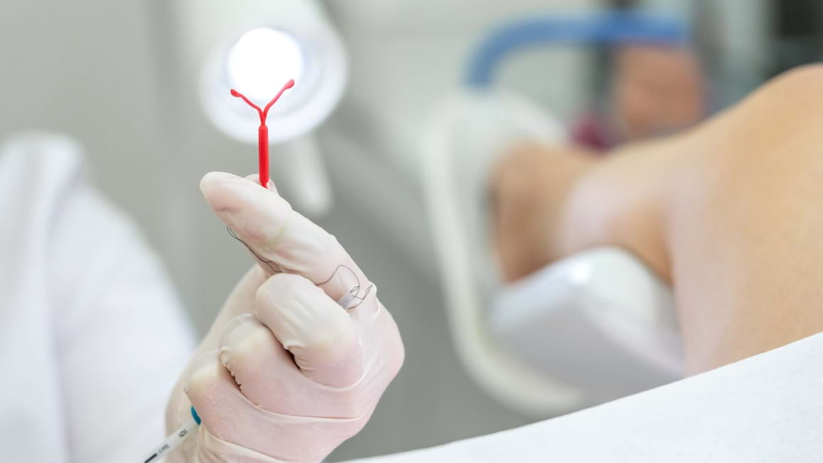 Steriletul: tipuri, eficacitate, avantaje si dezavantaje