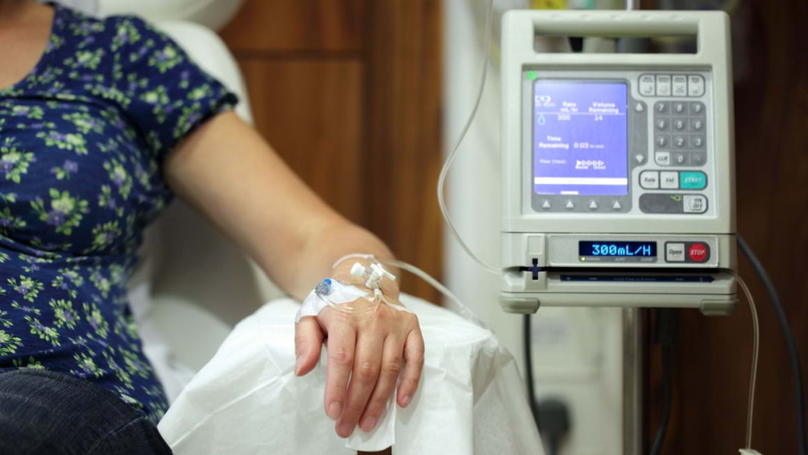 Chimioterapia, folosita in tratarea lupusului - este sau nu eficienta?