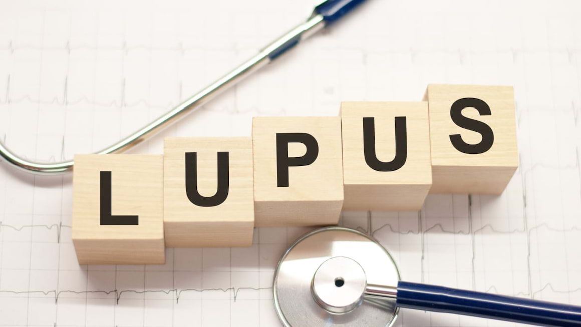 Principalele cauze de deces in lupus