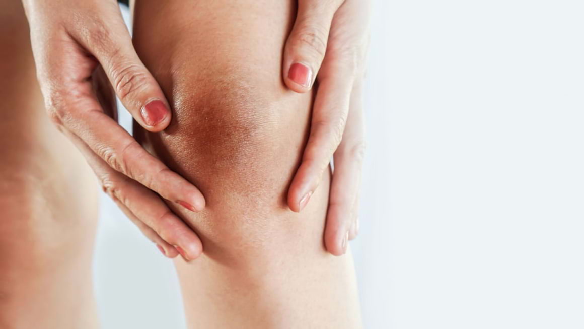 Neurodermatita: cauze, simptome, tratament