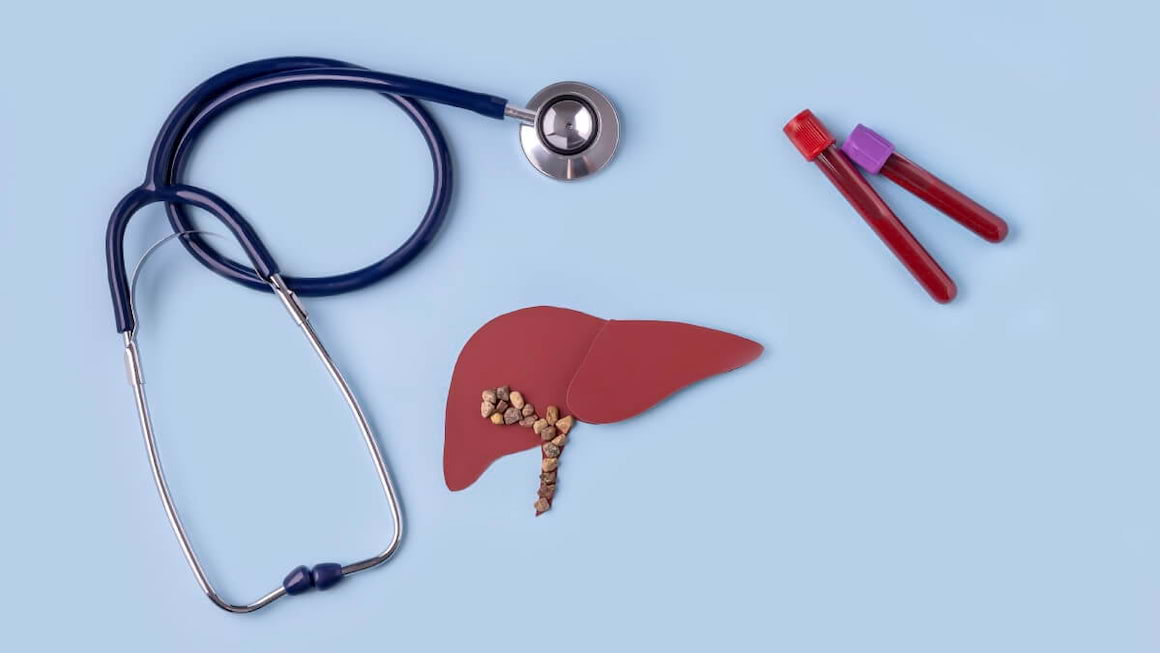 Steatoza hepatica alcoolica: cand apare si cum se trateaza