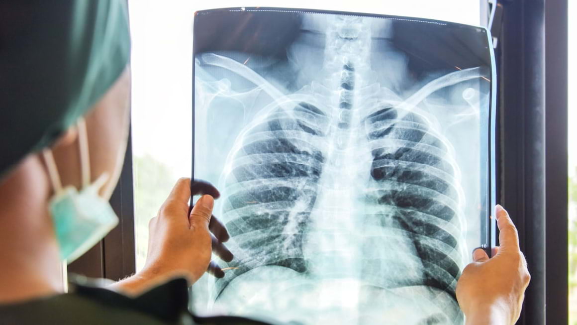 Tigara electronica poate cauza boli pulmonare