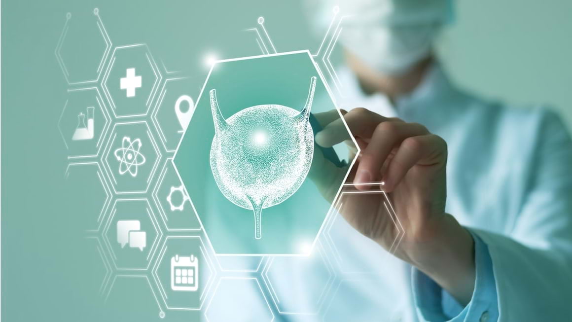Cancerul metastatic al vezicii urinare, intre chimioterapie si imunoterapie