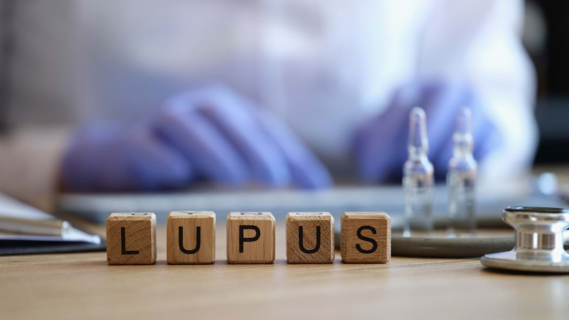 Directii noi de cercetare pentru tratament in lupus