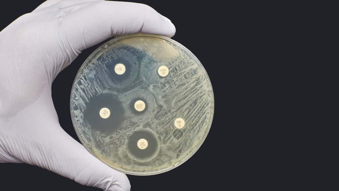 Totul despre antibiograma - cand este necesara si ce indica?