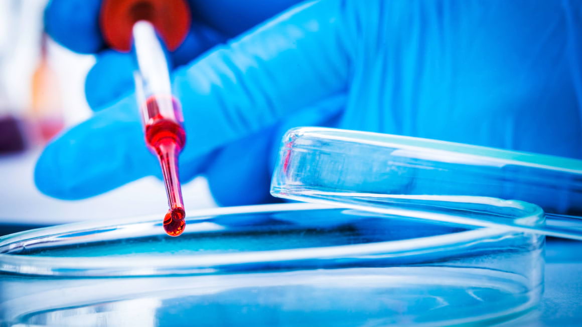 Biopsia lichida – instrument in personalizarea tratamentului in cancerul colorectal