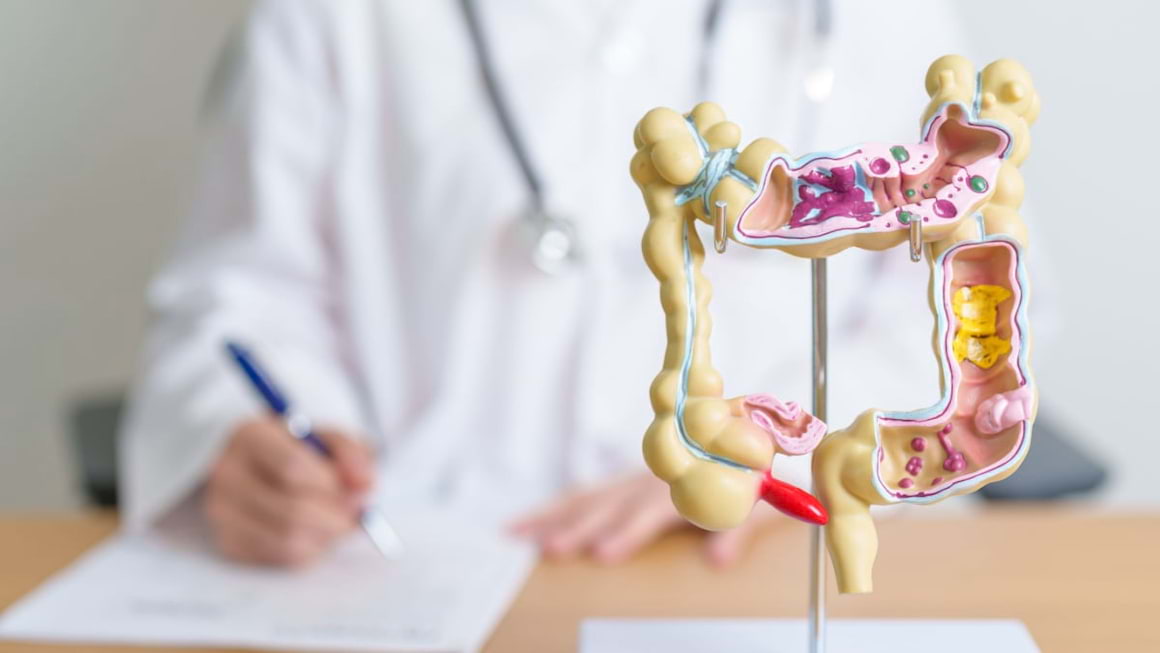 Boala Crohn vs colita ulcerativa - asemanari si deosebiri