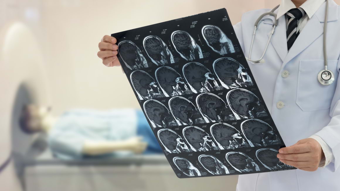 Diagnosticul AVC - informatii utile