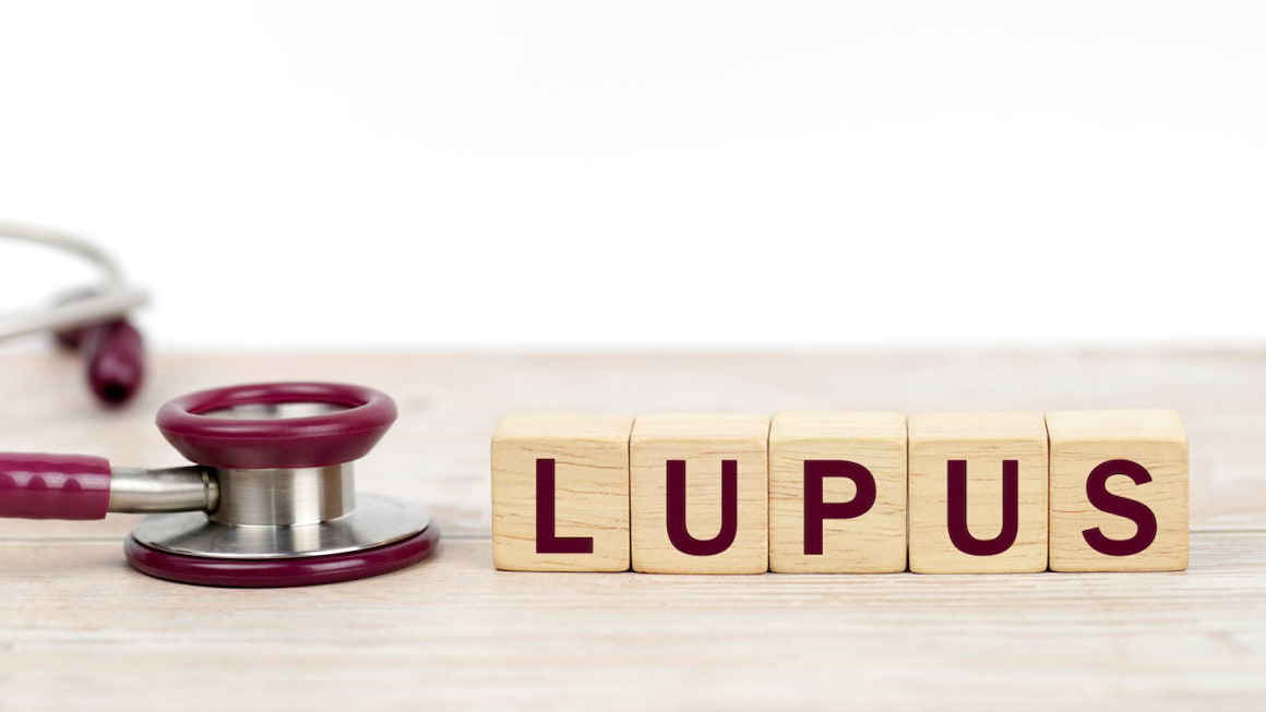 Informatii cheie despre lupus, pe scurt