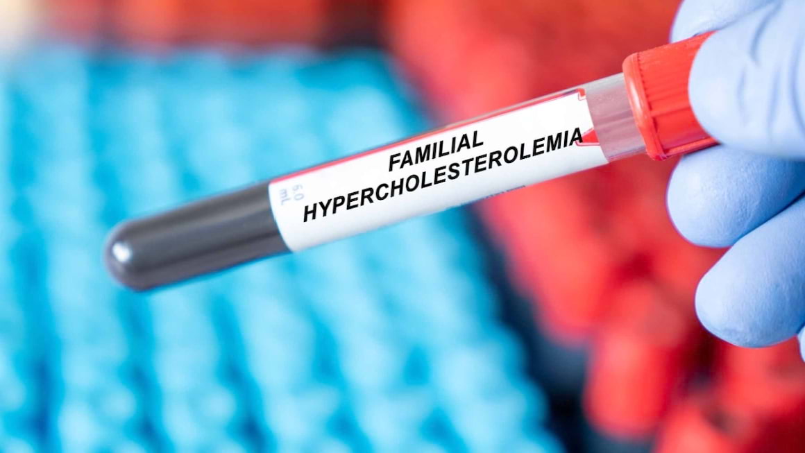 Hipercolesterolemia familiala: cauze, simptome, tratament, diagnostic
