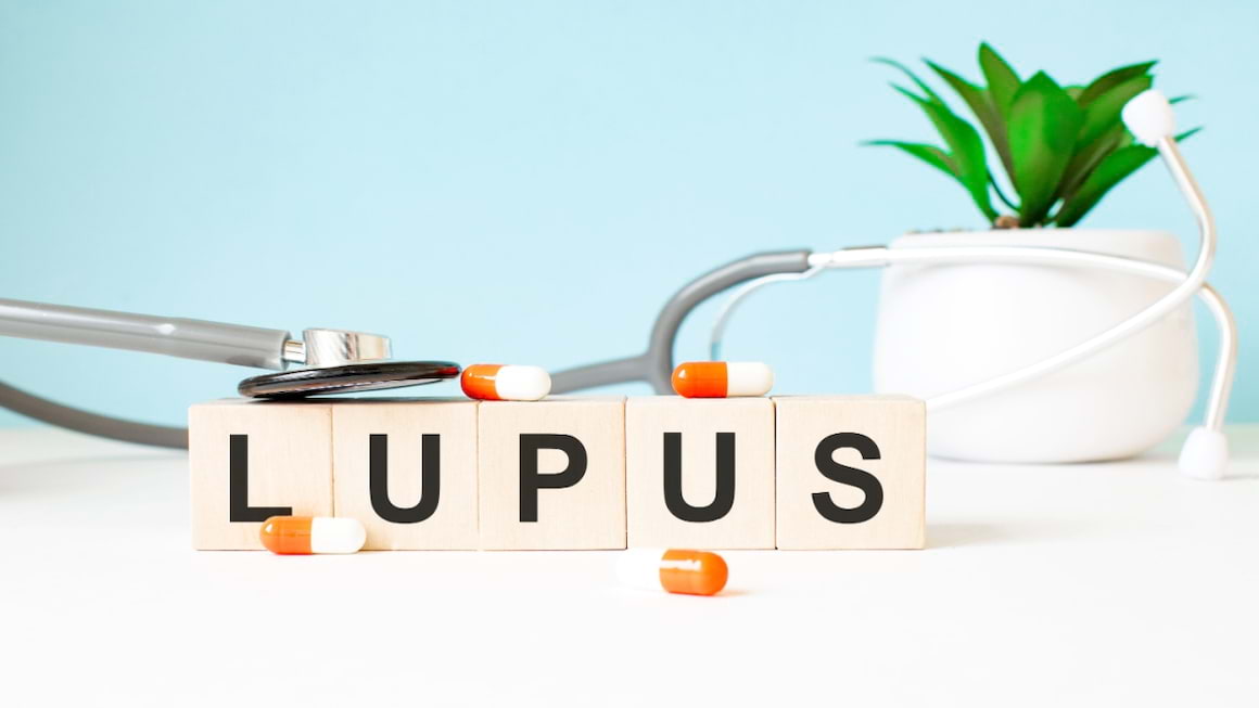 Optiuni de tratament in lupus eritematos sistemic
