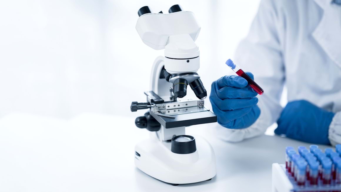 Un test de sange detecteaza proteinele care au legatura cu boala Alzheimer