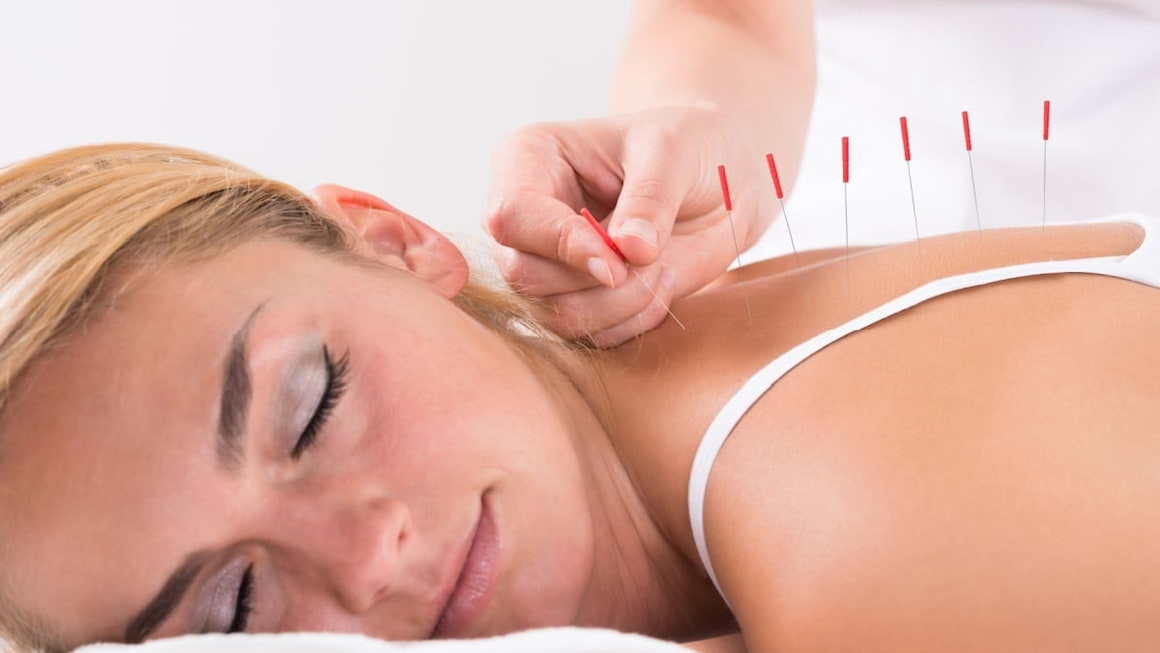 Acupunctura și secretele medicinei tradiționale chineze