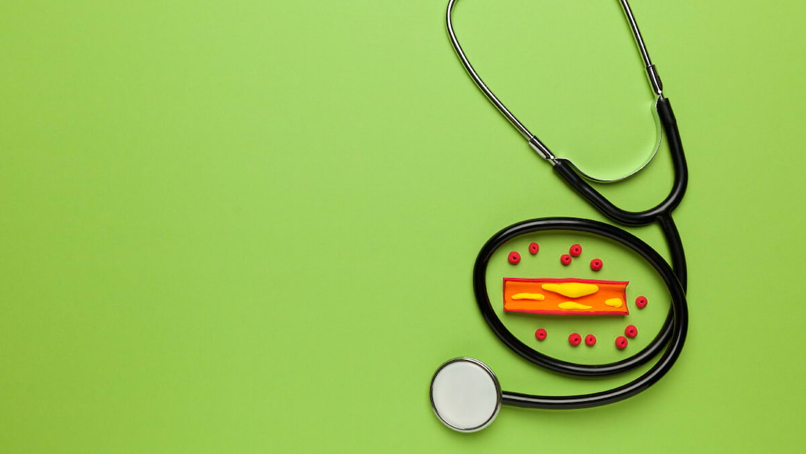 Diabetul si colesterolul - De ce influenteaza diabetul atat de mult valorile colesterolului?