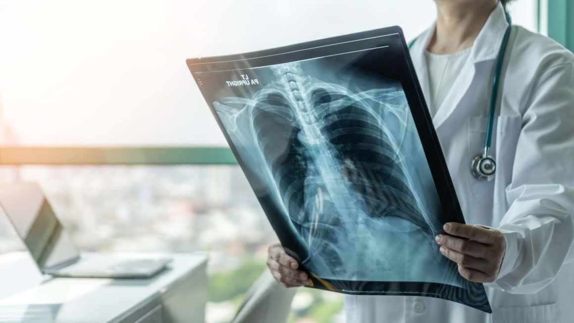 Lucruri esentiale despre cancerul pulmonar