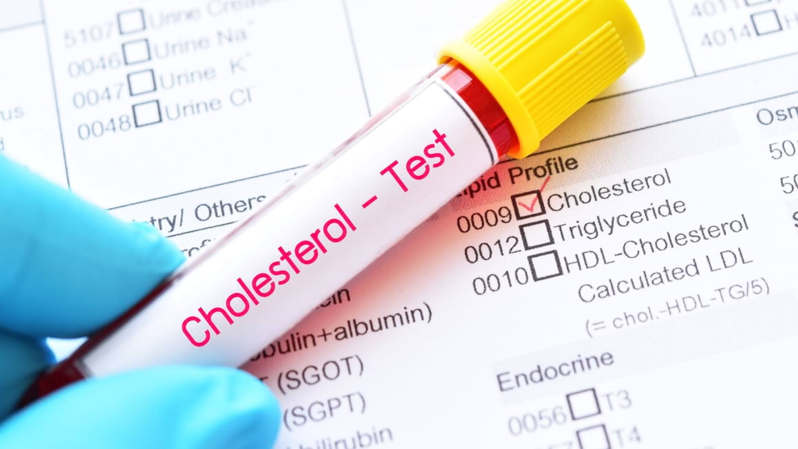 Dislipidemia la copii: simptome, diagnostic, tratament