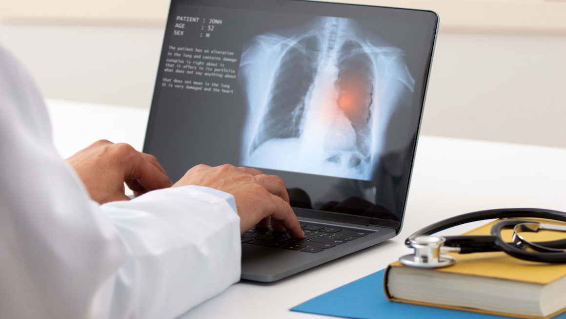 Efortul fizic la pacientii cu cancer pulmonar