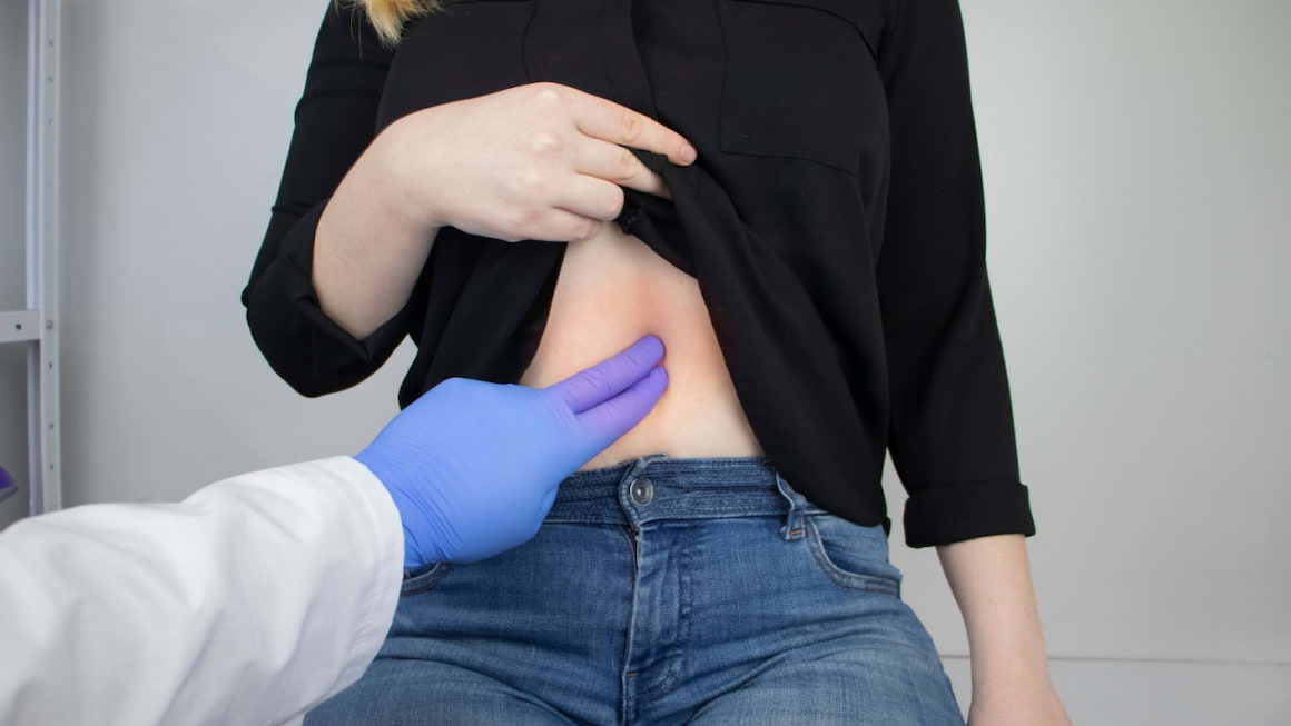 Femeile, mai afectate de anevrismul de aorta
