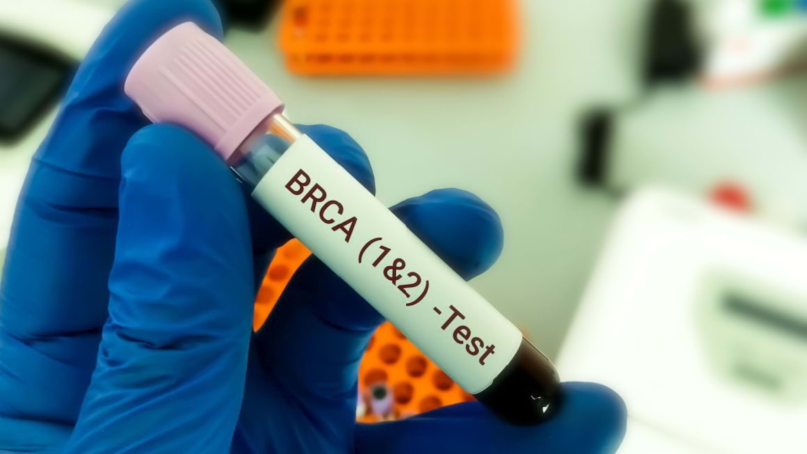 Mutatiile genelor BRCA1 si BRCA2 la persoanele sanatoase: semnificatie si recomandari