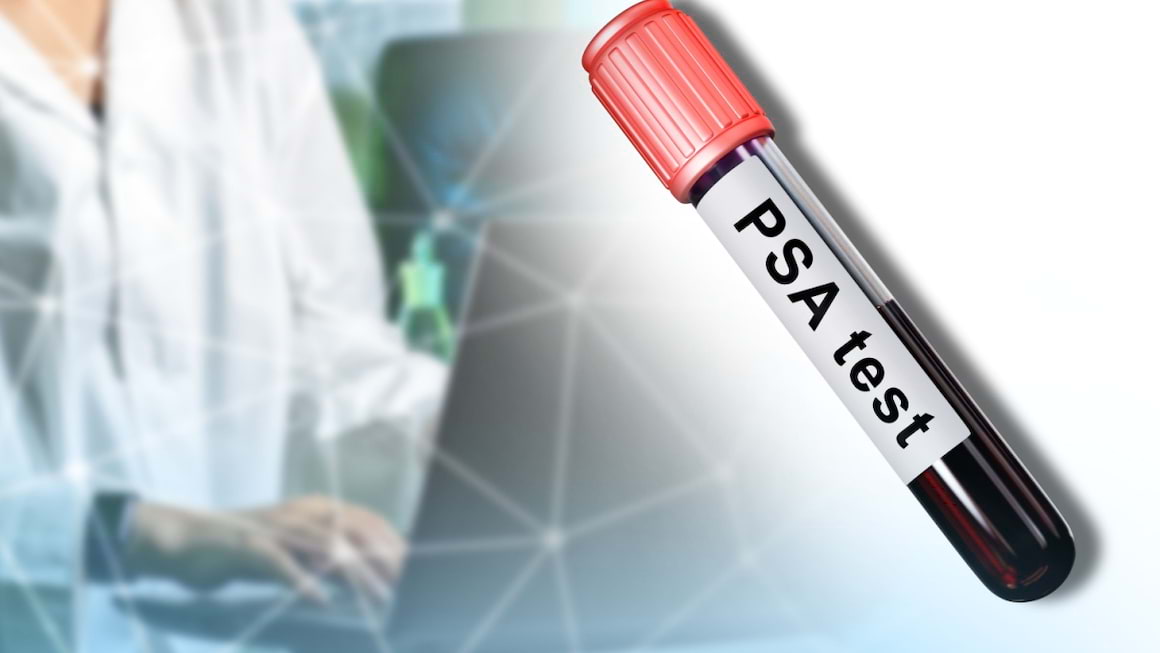 Antigenul prostatic specific (PSA) - instrument util în screening-ul cancerului prostatic?