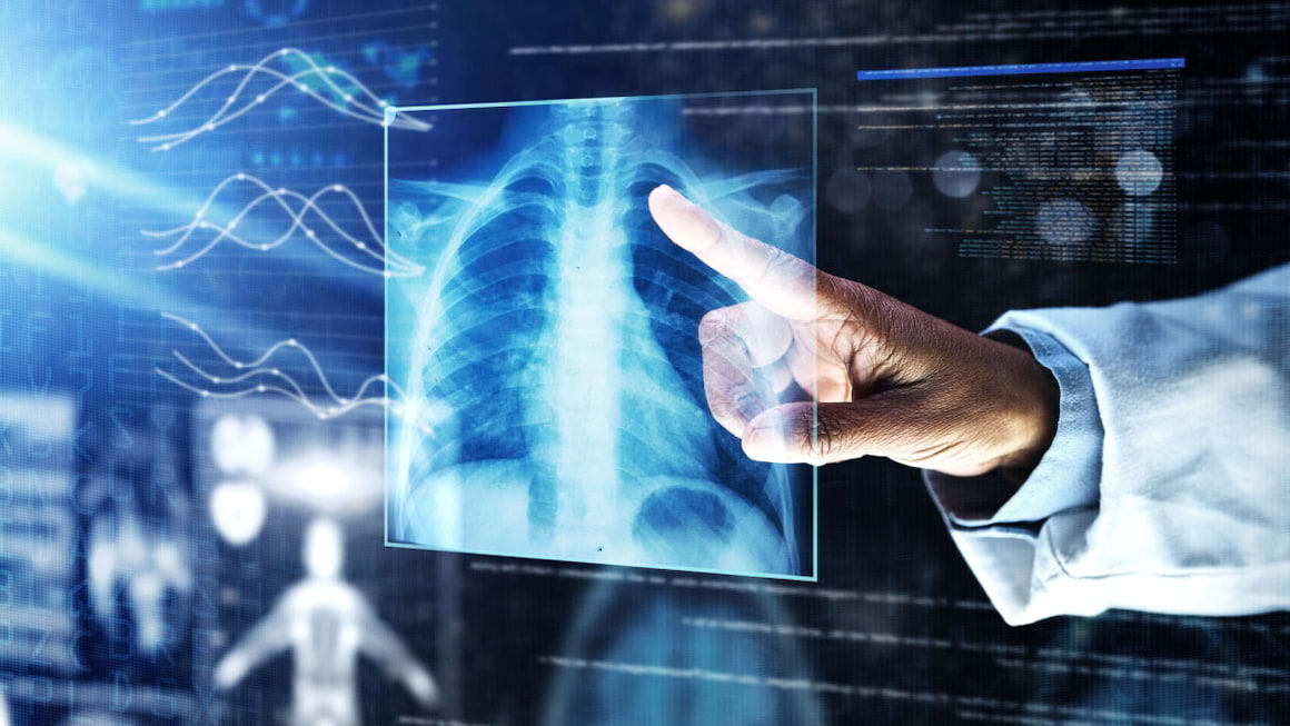 Ce este cancerul pulmonar?